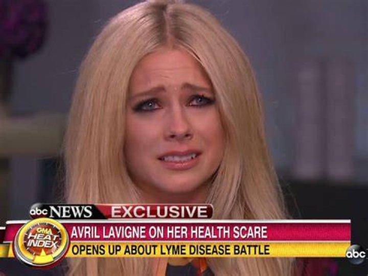 Avril Lavigne on Lyme Disease &acirc;&euro;&tilde;I Had Accepted That I Was Dying&acirc;