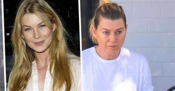 Ellen Pompeo's Transformation: The Truth About Her Fillers