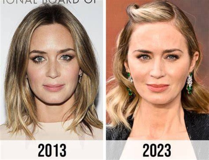 Emily Blunt Before and After From 2004 to 2024 The Skincare Edit