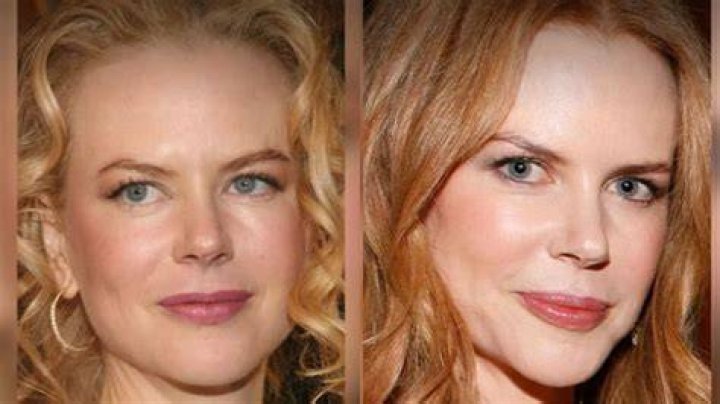 Has Nicole Kidman's Nose Been Surgically Altered? Exploring The Rumors And Evidence