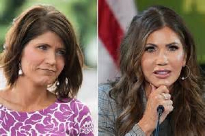 Has Plastic Surgery Enhanced Kristi Noem's Appearance? Unraveling The Speculations
