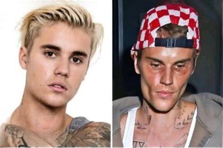 Justin Bieber's Tragic Passing: A Shocking Loss To The Music World