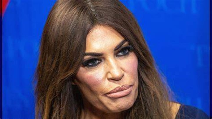 Kimberly Guilfoyle's Changing Appearance: Unveiling The Transformative Journey Behind Her Face