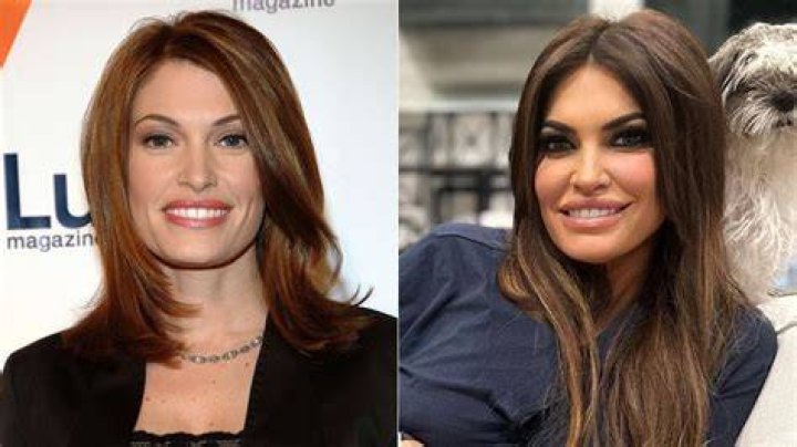 Kimberly Guilfoyle's Facial Transformation: Uncovering Its Evolution