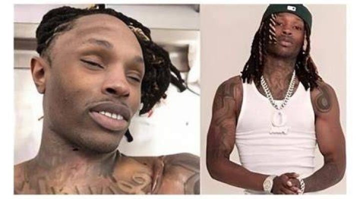 King Von Autopsy Photo: A Sobering Reality Of Gun Violence