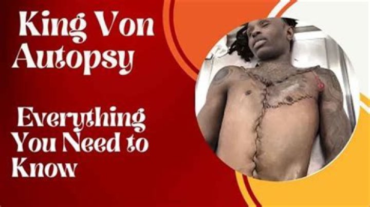 King Von Autopsy Report Released: Shocking Details Uncovered