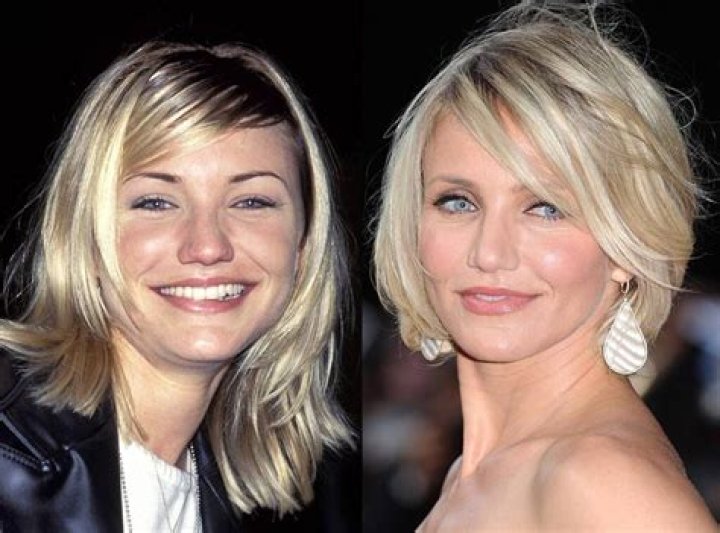Nicole s nip tuck nightmare plastic surgeons blame facelift fillers
