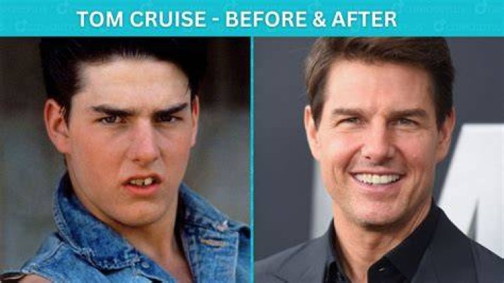 Pin on Celebrities Before and after