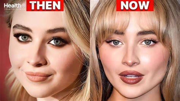 Sabrina Carpenter's Face Filler: The Surprising Truth