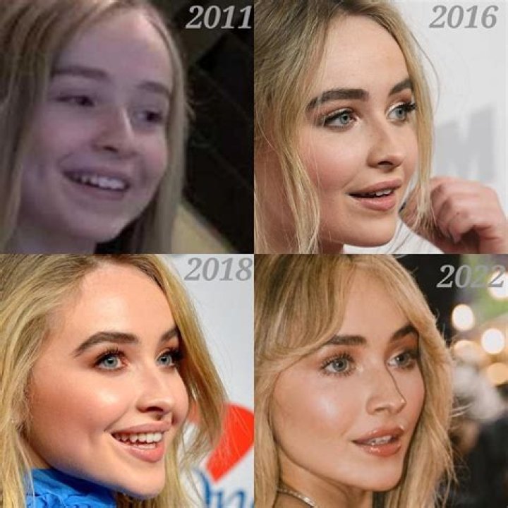 Sabrina Carpenter: The Truth About Her Lip Injections