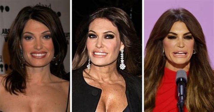 The Dramatic Transformation Of Kim Guilfoyle Before And After