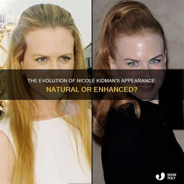 The Evolution Of Nicole Kidman's Appearance: A Look At Plastic Surgery Speculation