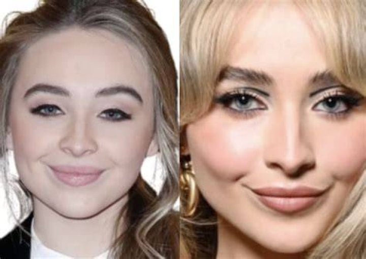 The Real Truth About Sabrina Carpenter's Plastic Surgery Rumors