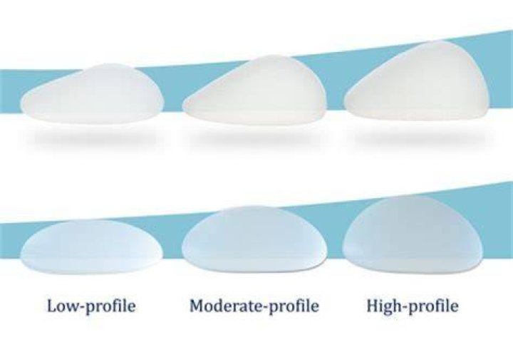 The Truth About Sabrina Carpenter's Breast Implants: A Comprehensive Guide