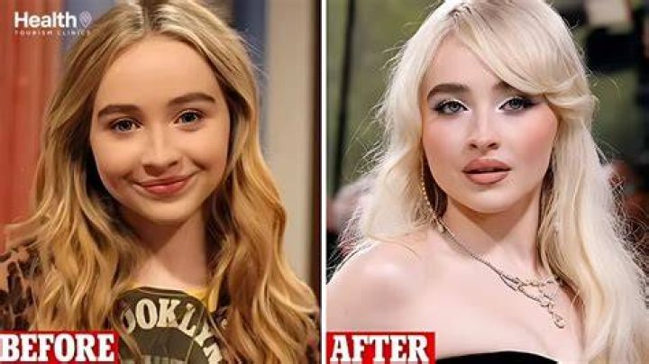 The Truth About Sabrina Carpenter's Natural Beauty: A Journey Without Plastic Surgery