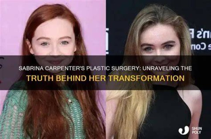 The Truth About Sabrina Carpenter's Plastic Surgery Speculations