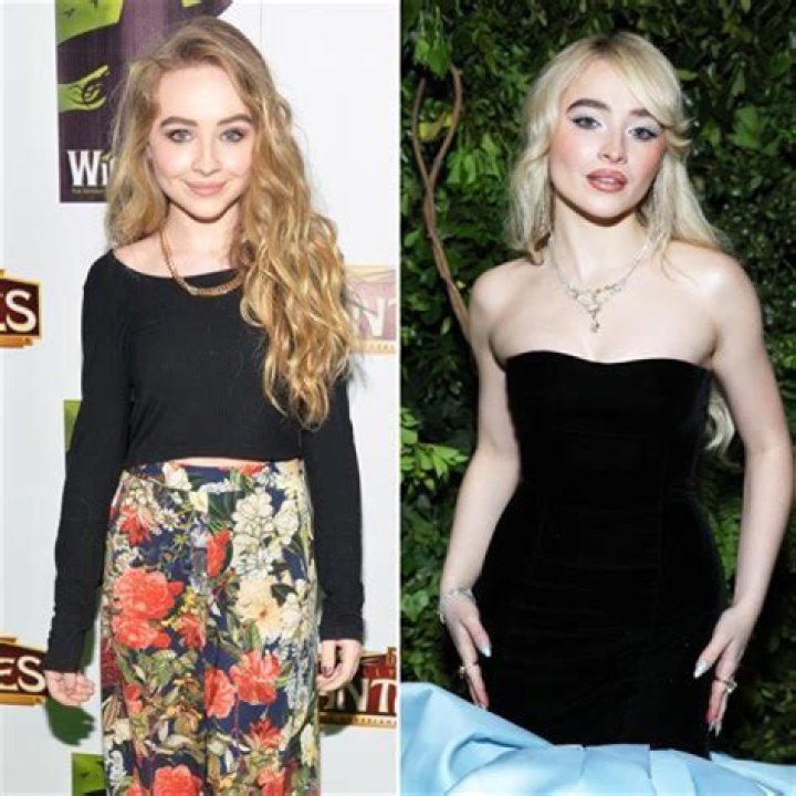 The Ultimate Guide To Sabrina Carpenter's Surgery Journey