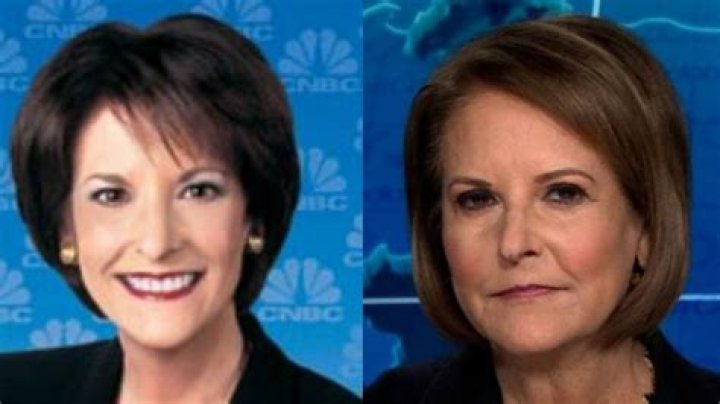 Ultimate Guide: Unveiling Gloria Borger's Plastic Surgery Journey