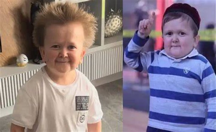 Uncover Hasbulla's Age: How Old Is The Internet Sensation?