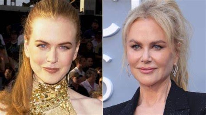Uncovering The Secrets: How Much Cosmetic Work Has Nicole Kidman Undergone?