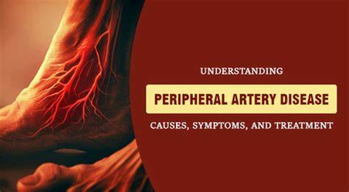 Understanding Adria Height Illness: Causes, Symptoms, And Treatment