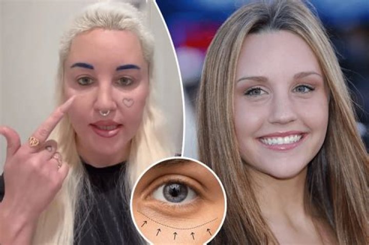 Unveiling Vanessa Hudgens' Plastic Surgery Journey